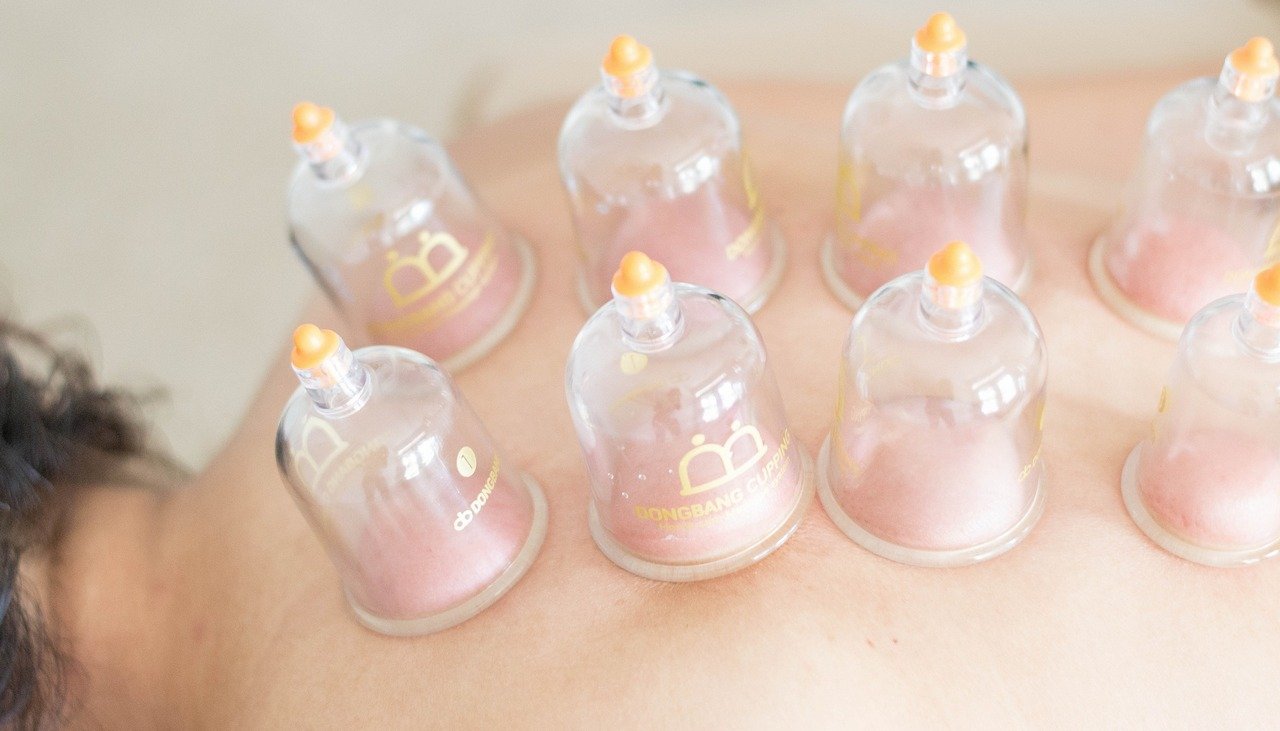 aniko-massage-cupping01